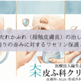 よだれかぶれ（接触皮膚炎）の治し方｜口周りの赤みに対するワセリン保護と薬