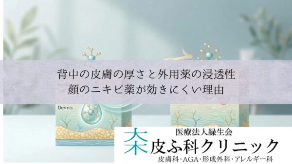 背中の皮膚の厚さと外用薬の浸透性｜顔のニキビ薬が効きにくい理由