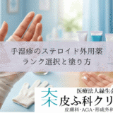 手湿疹のステロイド外用薬｜アンテベート・マイザー等のランク選択と塗り方
