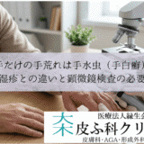 片手だけの手荒れは手水虫（手白癬）？｜手湿疹との違いと顕微鏡検査の必要性