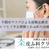 不織布マスクによる接触皮膚炎｜ヒリヒリする摩擦とかぶれの治療
