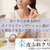 赤ニキビがある時のメイクとファンデーション選び｜炎症を悪化させない化粧とクレンジング