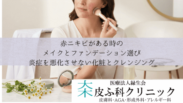赤ニキビがある時のメイクとファンデーション選び｜炎症を悪化させない化粧とクレンジング