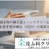 寝る時の綿手袋とハンドクリーム｜手荒れを治す密封療法（ODT）の効果と注意点