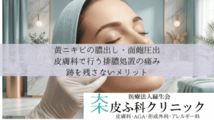 黄ニキビの膿出し・面皰圧出｜皮膚科で行う排膿処置の痛みと跡を残さないメリット