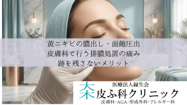 黄ニキビの膿出し・面皰圧出｜皮膚科で行う排膿処置の痛みと跡を残さないメリット