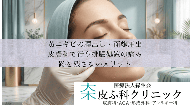黄ニキビの膿出し・面皰圧出｜皮膚科で行う排膿処置の痛みと跡を残さないメリット