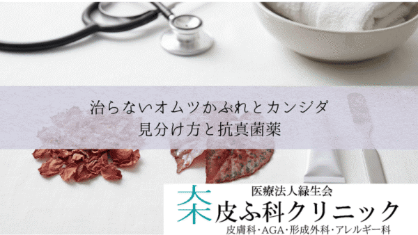 治らないオムツかぶれとカンジダ（乳児寄生菌性紅斑）｜見分け方と抗真菌薬