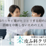 皮膚科のニキビ薬がヒリヒリする時の対処法｜治療を中断しないための工夫