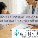 子供のニキビで皮膚科を受診する目安｜保護者が確認すべき症状と保険適用