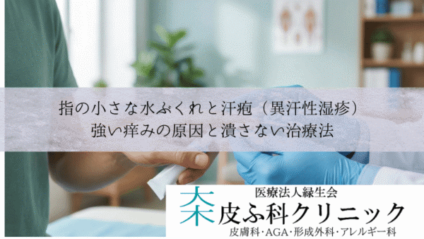 指の小さな水ぶくれと汗疱（異汗性湿疹）｜強い痒みの原因と潰さない治療法