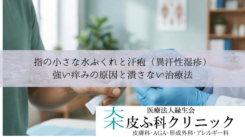 指の小さな水ぶくれと汗疱（異汗性湿疹）｜強い痒みの原因と潰さない治療法