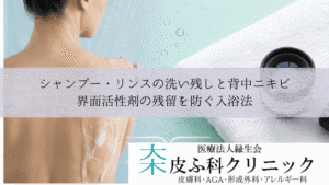 シャンプー・リンスの洗い残しと背中ニキビ|界面活性剤の残留を防ぐ入浴法