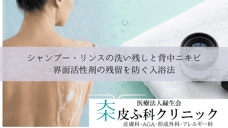 シャンプー・リンスの洗い残しと背中ニキビ|界面活性剤の残留を防ぐ入浴法