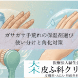 ガサガサ手荒れの保湿剤選び｜尿素軟膏とヘパリン類似物質の使い分けと角化対策