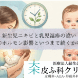 新生児ニキビと乳児湿疹の違い｜母親のホルモン影響といつまで続くかの目安