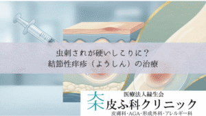 虫刺されが硬いしこりに？結節性痒疹（ようしん）の治療｜ステロイド注射とテープ剤