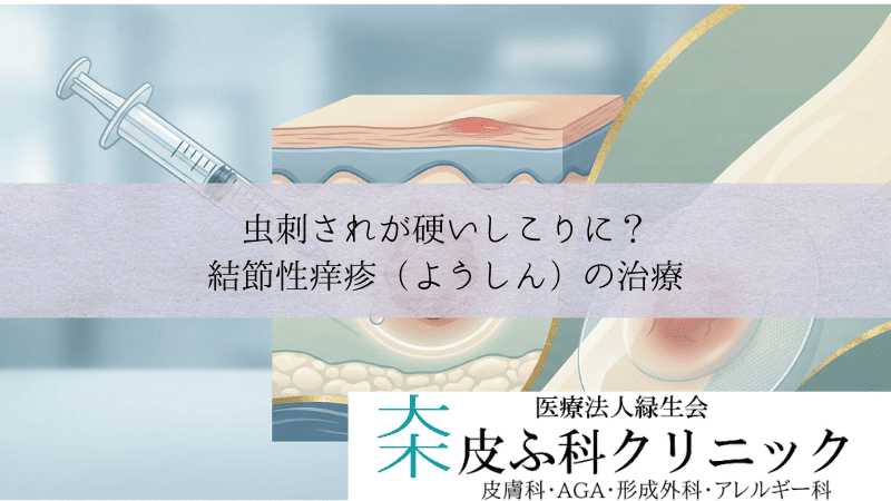 虫刺されが硬いしこりに？結節性痒疹（ようしん）の治療｜ステロイド注射とテープ剤