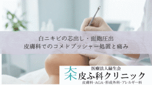 白ニキビの芯出し・面皰圧出|皮膚科でのコメドプッシャー処置と痛み