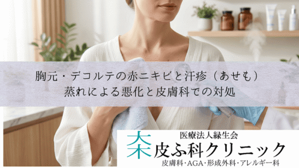 胸元・デコルテの赤ニキビと汗疹（あせも）｜蒸れによる悪化と皮膚科での対処