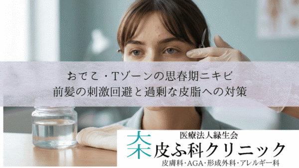おでこ・Tゾーンの思春期ニキビ｜前髪の刺激回避と過剰な皮脂への対策