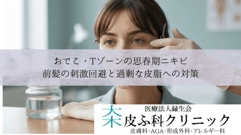 おでこ・Tゾーンの思春期ニキビ｜前髪の刺激回避と過剰な皮脂への対策