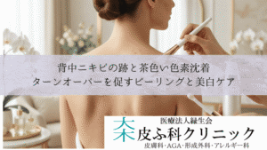 背中ニキビの跡と茶色い色素沈着｜ターンオーバーを促すピーリングと美白ケア