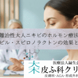 難治性大人ニキビのホルモン療法｜低用量ピル・スピロノラクトンの効果と副作用