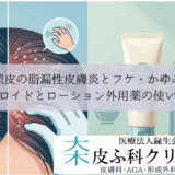 頭皮の脂漏性皮膚炎とフケ・かゆみ｜ステロイドとローション外用薬の使い分け