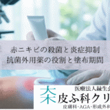 赤ニキビの殺菌と炎症抑制｜抗菌外用薬（ダラシン・アクアチム）の役割と塗布期間