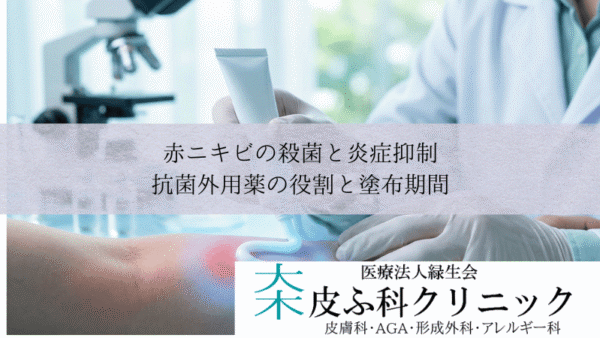 赤ニキビの殺菌と炎症抑制｜抗菌外用薬（ダラシン・アクアチム）の役割と塗布期間