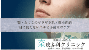 顎・おでこのザラザラ肌と微小面皰｜目に見えないニキビ予備軍のケア