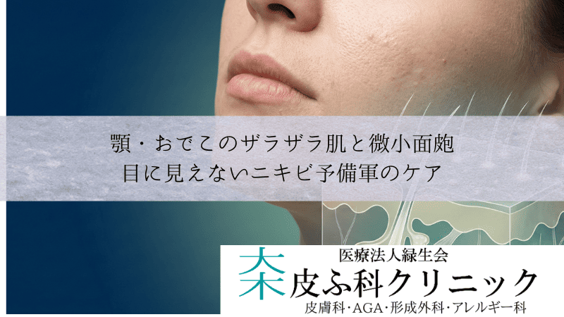 顎・おでこのザラザラ肌と微小面皰｜目に見えないニキビ予備軍のケア