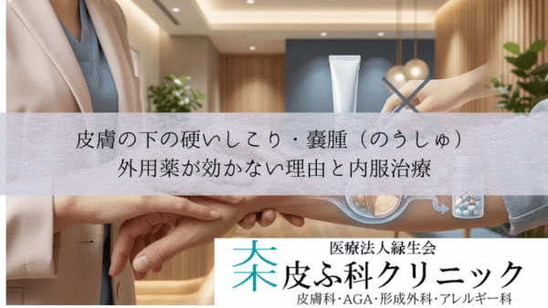 皮膚の下の硬いしこり・嚢腫（のうしゅ）｜外用薬が効かない理由と内服治療