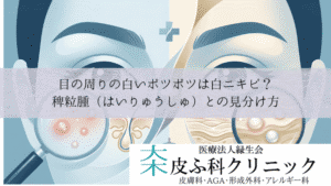 目の周りの白いポツポツは白ニキビ?稗粒腫(はいりゅうしゅ)との見分け方