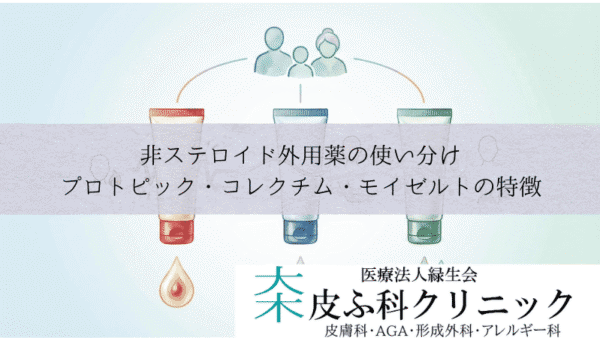 非ステロイド外用薬の使い分け｜プロトピック・コレクチム・モイゼルトの特徴