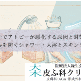汗でアトピーが悪化する原因と対策｜痒みを防ぐシャワー・入浴とスキンケア