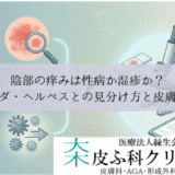 陰部の痒みは性病か湿疹か？｜カンジダ・ヘルペスとの見分け方と皮膚科検査