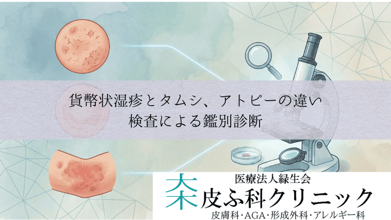 貨幣状湿疹とタムシ(体部白癬)・アトピーの違い|検査による鑑別診断