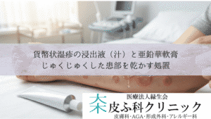 貨幣状湿疹の浸出液（汁）と亜鉛華軟膏｜じゅくじゅくした患部を乾かす処置