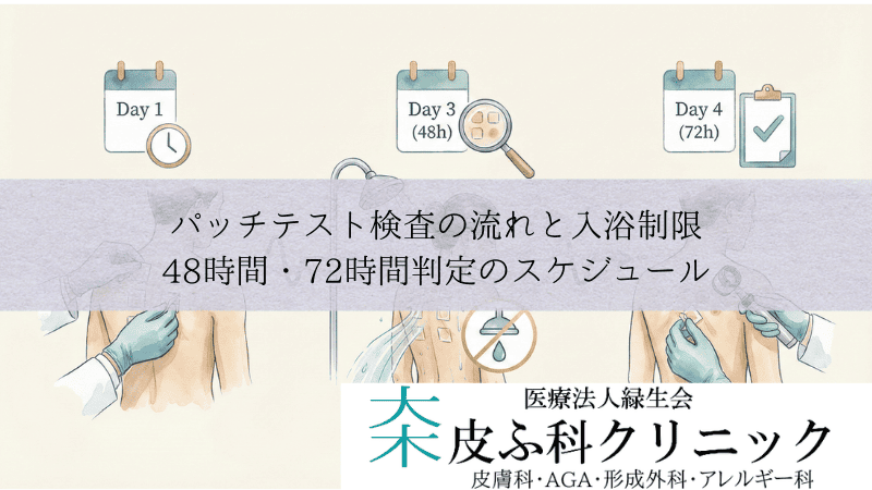 パッチテスト検査の流れと入浴制限|48時間・72時間判定のスケジュール