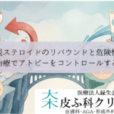 脱ステロイドのリバウンドと危険性｜標準治療でアトピーをコントロールする意義