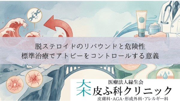 脱ステロイドのリバウンドと危険性｜標準治療でアトピーをコントロールする意義