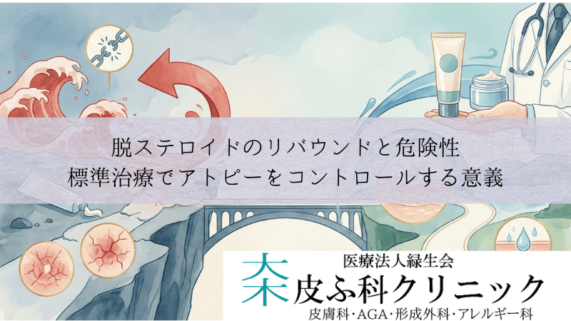 脱ステロイドのリバウンドと危険性|標準治療でアトピーをコントロールする意義