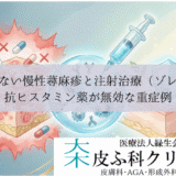 治らない慢性蕁麻疹と注射治療（ゾレア）｜抗ヒスタミン薬が無効な重症例