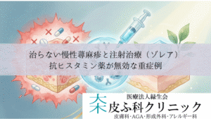 治らない慢性蕁麻疹と注射治療(ゾレア)|抗ヒスタミン薬が無効な重症例