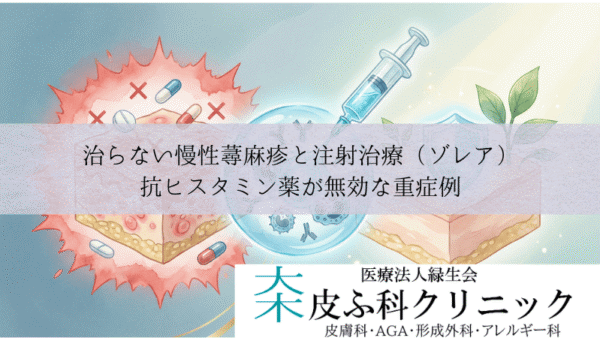 治らない慢性蕁麻疹と注射治療（ゾレア）｜抗ヒスタミン薬が無効な重症例