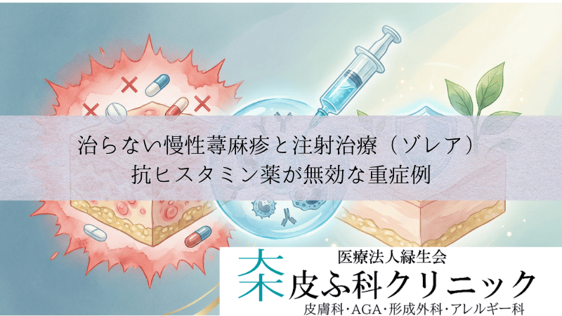 治らない慢性蕁麻疹と注射治療(ゾレア)|抗ヒスタミン薬が無効な重症例