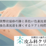 貨幣状湿疹の跡と茶色い色素沈着｜炎症後色素沈着を薄くするケアと時間経過