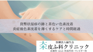 貨幣状湿疹の跡と茶色い色素沈着｜炎症後色素沈着を薄くするケアと時間経過